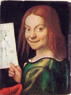 Angelman Sendromu — resim 2