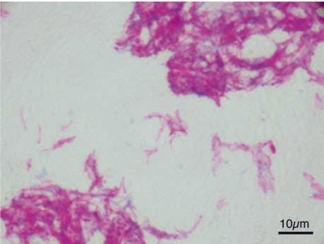 BCG Aşısı (Bacillus Calmette-Guérin) — resim 2