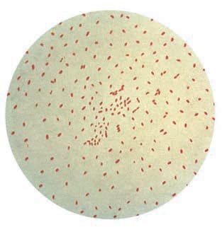 Bordetella Pertusis — resim 2