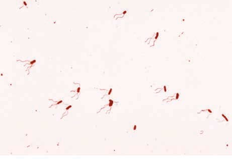 Bordetella Pertusis — resim 4