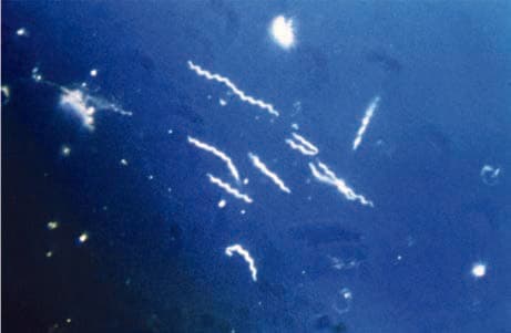 Borrelia Burgdorferi — resim 4