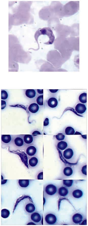 Chagas Hastalığı — resim 2