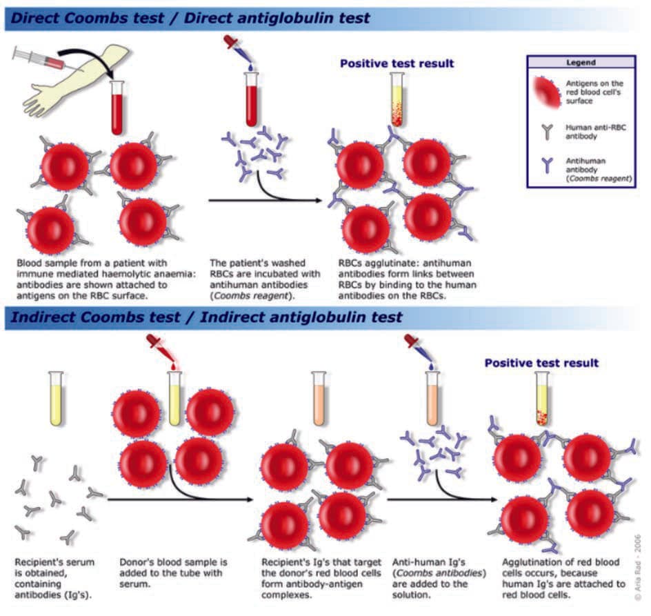 Coombs Testi — resim 2