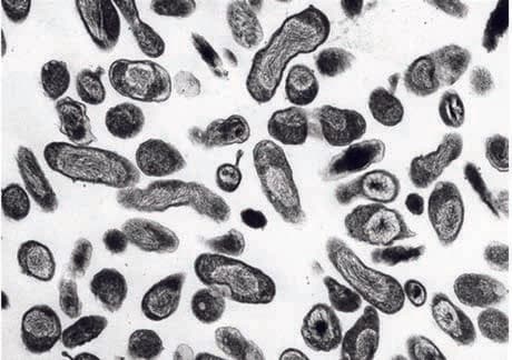 Coxiella Burnetii — resim 4