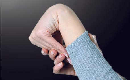 Ehlers-Danlos Hastalığı — resim 5