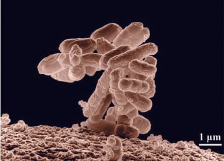 Escherichia Coli — resim 2