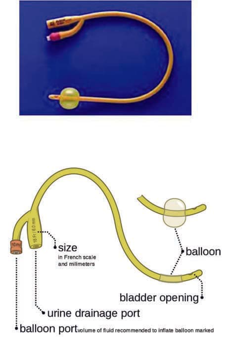 Foley Sonda — resim 2