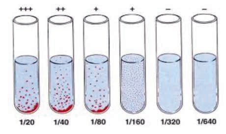 Gruber-Widal Testi — resim 3
