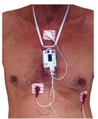 Holter Monitörü — resim 4