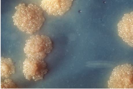 Koch Basili — resim 4