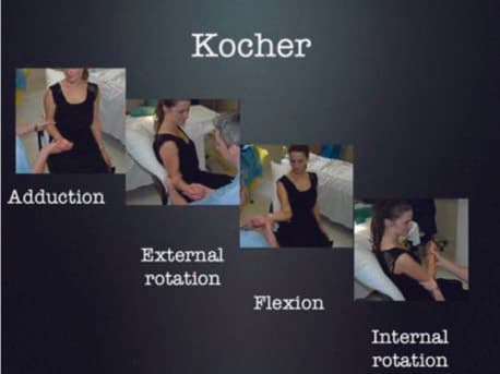 Kocher Manevrası — resim 2