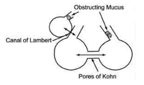 Kohn Gözenekleri — resim 4