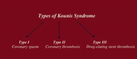 Kounis Sendromu — resim 2