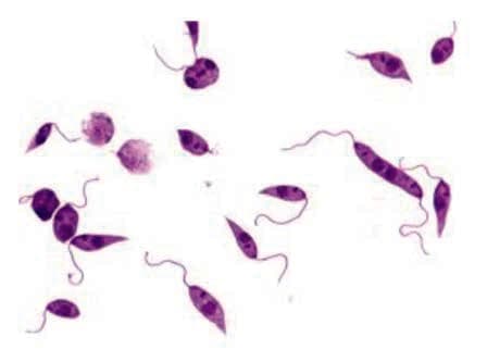 Leishmania Donovani — resim 3