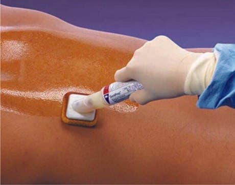 Lister'in Antiseptik Solüsyonu — resim 3