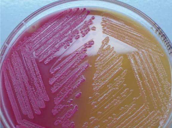 MacConkey Agar — resim 2