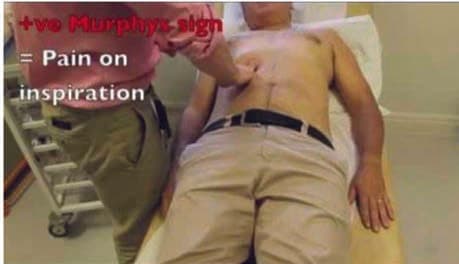 Murphy Belirtisi — resim 3