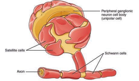Schwannoma — resim 3