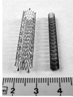 Stent — resim 2