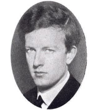 Waldenström Makroglobulinemisi — resim 1