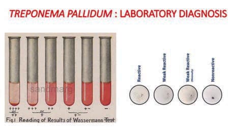 Wassermann Testi — resim 2