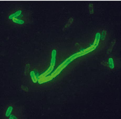 Yersinia Pestis — resim 3