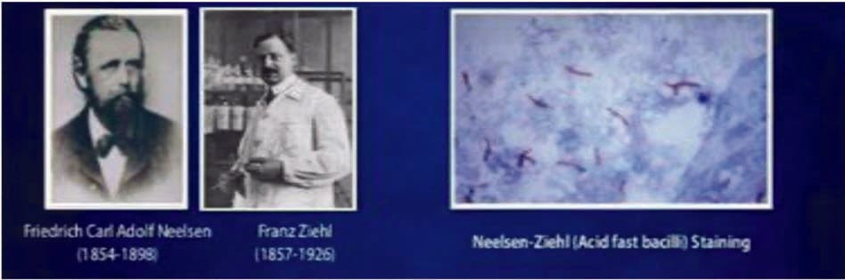 Ziehl-Neelsen Boyası — resim 2