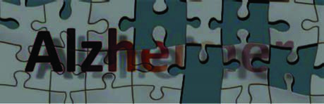 Alzheimer Hastalığı — resim 2