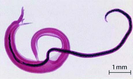 Schistosoma haematobium; Erkek (Pembe renkli) /Dişi  (ince ve uzun )