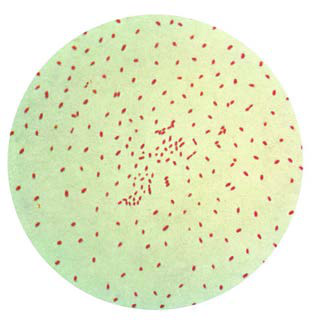 Bordetella Pertusis — resim 2