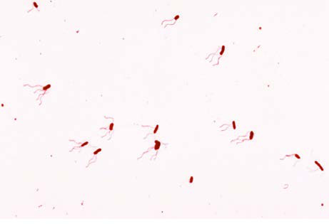 Bordetella Pertusis — resim 3