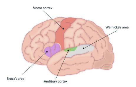 Broca Afazisi — resim 3