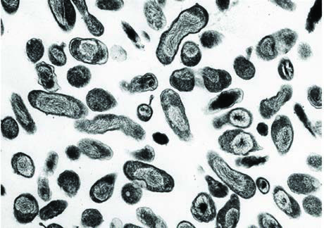 Coxiella Burnetii — resim 4