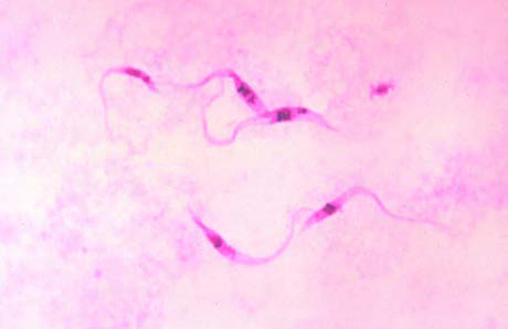 Giemsa stained Trypanosoma parasites (Chagas disease  pathogen)