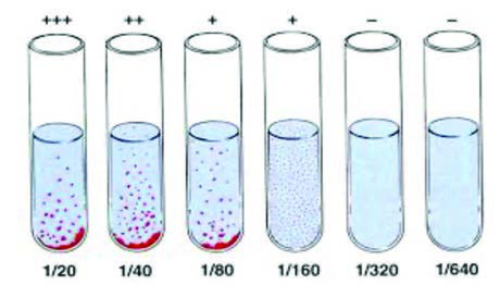 Gruber-Widal Testi — resim 3