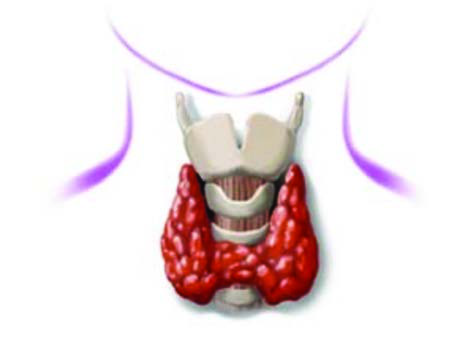 Hashimoto Tiroiditi — resim 3