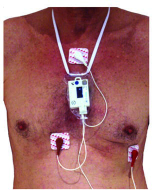 Holter Monitörü — resim 4