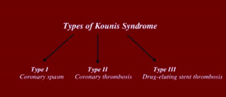 Kounis Sendromu — resim 2