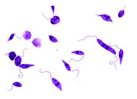 Leishmania Donovani — resim 3