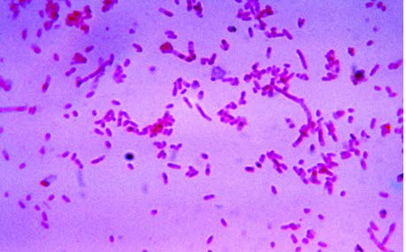 Fusobacterium novum, bir tiyoglikolat besiyerinde  kültürlendikten sonra.