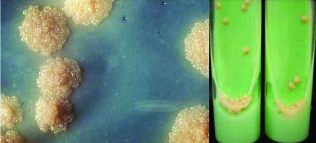 Mycobacterium tuberculosis’in kültür özellikleri.