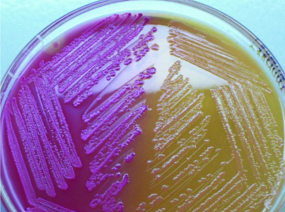 LF ve LF olmayan koloniler içeren MacConkey agar.  Soldaki organizma, pembe renkle kanıtlandığı gibi bir laktoz  fermenteridir. Sağdaki organizma renk üretmedi, bu nedenle bir  laktoz fermenter gibi görünmüyor.