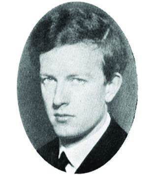 Waldenström Makroglobulinemisi — resim 1