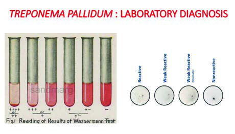 Wassermann Testi — resim 2
