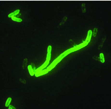 Yersinia Pestis — resim 2