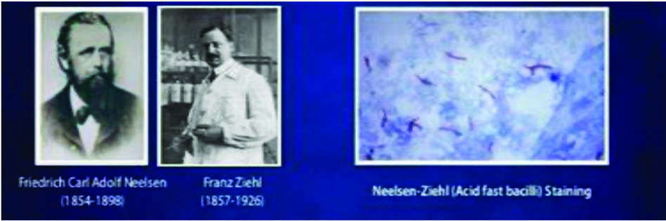 Ziehl-Neelsen Boyası — resim 2